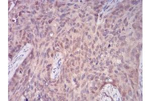 Immunohistochemistry (IHC) image for anti-phospholipase C, gamma 1 (PLCG1) (AA 1192-1291) antibody (ABIN5542680)