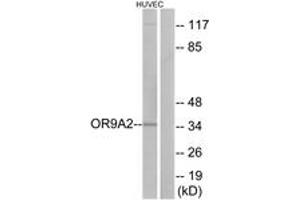 Western blot analysis of extracts from HuvEc cells, using OR9A2 Antibody.