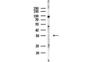 anti-Carbonic Anhydrase XIII (CA13) (Internal Region) antibody