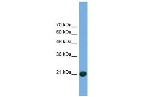 WB Suggested Anti-COMMD8 Antibody Titration: 0. (COMMD8 Antikörper  (Middle Region))