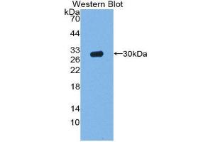 Western Blotting (WB) image for anti-Acid Phosphatase 5, Tartrate Resistant (ACP5) (AA 28-286) antibody (ABIN1857872)