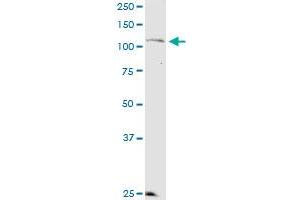 KSR2 monoclonal antibody (M08), clone 1G4. (KSR2 Antikörper  (AA 411-500))