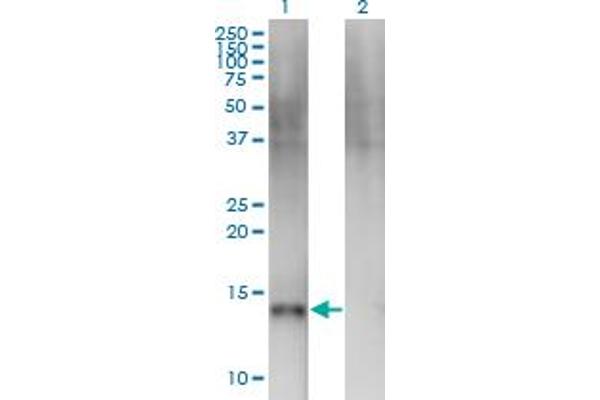 SEMA4B anticorps  (AA 592-689)