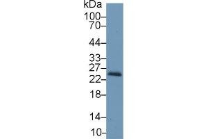 Western blot analysis of Mouse Kidney lysate, using Mouse RBP4 Antibody (1 µg/ml) and HRP-conjugated Goat Anti-Rabbit antibody (