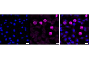 Immunocytochemical staining of C2C12 cells with Fibroblast growth factor 21 antibody (ABIN7798606), 1:1,000). (Rekombinanter FGF21 Antikörper)