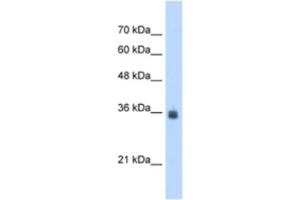 Western Blotting (WB) image for anti-Stromal Cell Derived Factor 4 (SDF4) antibody (ABIN2463052)