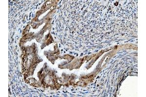 IHC analysis of PDIA6 using anti-PDIA6 antibody (ABIN7600553). (PDIA6 Antikörper  (AA 20-440))