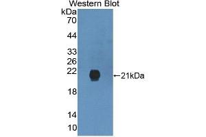 Detection of Recombinant GREM2, Human using Polyclonal Antibody to Gremlin 2 (GREM2) (GREM2 Antikörper  (AA 22-168))