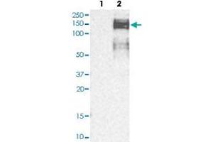 Western blot analysis of Lane 1: Human cell line RT-4; Lane 2: Human cell line U-251MG sp with ZEB1 polyclonal antibody  at 1:250-1:500 dilution. (ZEB1 Antikörper)