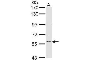 WB Image Sample (30 ug of whole cell lysate) A: Hep G2 , 7. (RCBTB2 Antikörper)