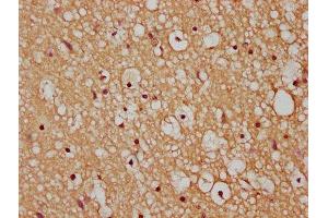 IHC image of ABIN7175445 diluted at 1:200 and staining in paraffin-embedded human brain tissue performed on a Leica BondTM system. (PTPLAD1 Antikörper  (AA 1-145))