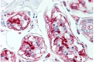 Human Skin, Sweat Glands (formalin-fixed, paraffin-embedded) stained with CD59 antibody ABIN298471 at 5 ug/ml followed by biotinylated anti-mouse IgG secondary antibody ABIN481714, alkaline phosphatase-streptavidin and chromogen. (CD59 Antikörper)