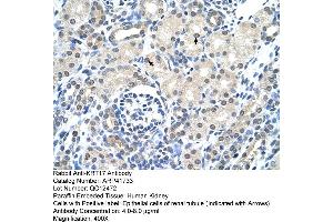 Rabbit Anti-KRT17 Antibody  Paraffin Embedded Tissue: Human Kidney Cellular Data: Epithelial cells of renal tubule Antibody Concentration: 4. (KRT17 Antikörper  (C-Term))