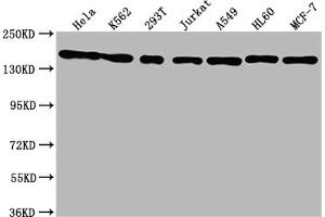 Western Blot Positive WB detected in: Hela whole cell lysate, K562 whole cell lysate, 293T whole cell lysate, Jurkat whole cell lysate, A549 whole cell lysate, HL60 whole cell lysate, MCF-7 whole cell lysate All lanes: SMC1A antibody at 1:1500 Secondary Goat polyclonal to rabbit IgG at 1/50000 dilution Predicted band size: 144 kDa Observed band size: 144 kDa (Rekombinanter SMC1A Antikörper)