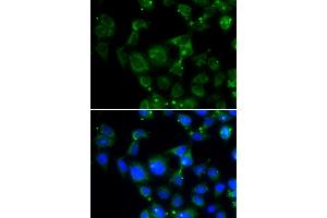 Immunofluorescence analysis of HeLa cells using MAPRE2 antibody (ABIN5974001). (MAPRE2 Antikörper)