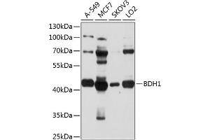 Western blot analysis of extracts of various cell lines, using BDH1 antibody (ABIN1678849, ABIN3018068, ABIN3018069 and ABIN6220349) at 1:1000 dilution. (BDH1 Antikörper  (AA 1-343))