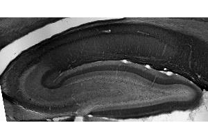 Adult rat hippocampus immunohistochemistry.