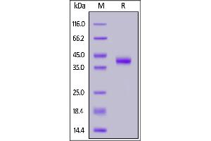 SDS-PAGE (SDS) image for Mucin 1 (MUC1) (AA 116-173) protein (Fc Tag) (ABIN7013640)