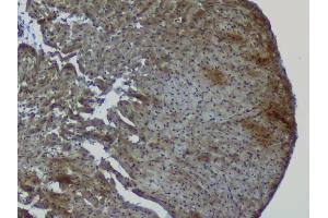 IHC analysis of NRF1 using anti-NRF1 antibody (ABIN6719347). (NRF1 Antikörper  (AA 246-503))