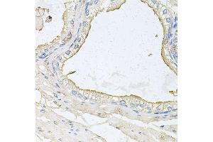 Immunohistochemistry of paraffin-embedded human prostate using HPR antibody (ABIN6003630) at dilution of 1/100 (40x lens). (HPR Antikörper)
