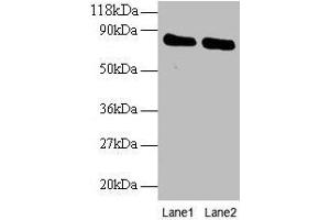 Western blot All lanes: OTUB1 antibody at 2 μg/mL Lane 1: EC109 whole cell lysate Lane 2: 293T whole cell lysate Secondary Goat polyclonal to rabbit IgG at 1/15000 dilution Predicted band size: 32, 36 kDa Observed band size: 80 kDa (OTUB1 Antikörper  (AA 2-201))