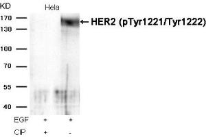 Western blot analysis of extracts from Hela cells, treated with EGF or calf intestinal phosphatase (CIP), using HER2 (Phospho-Tyr1221/Tyr1222) Antibody. (ErbB2/Her2 Antikörper  (pTyr1221, pTyr1222))