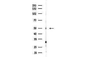 anti-Zinc Finger Protein 71 (ZNF71) antibody