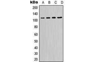 Western blot analysis of PI3K p110 delta expression in K562 (A), Raji (B), Raw264. (PIK3CD Antikörper  (C-Term))