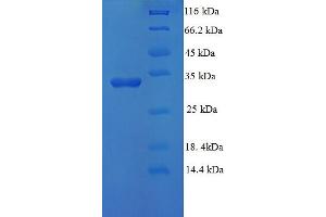 SDS-PAGE (SDS) image for Ubiquitin-Conjugating Enzyme E2D 3 (UBE2D3) (AA 1-147), (full length) protein (His-SUMO Tag) (ABIN5710584) (UBE2D3 Protein (AA 1-147, full length) (His-SUMO Tag))