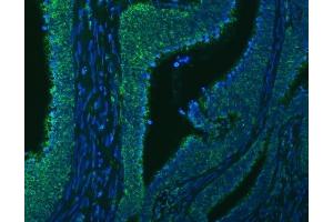 anti-Solute Carrier Family 20 (Phosphate Transporter), Member 1 (SLC20A1) (AA 79-494) antibody