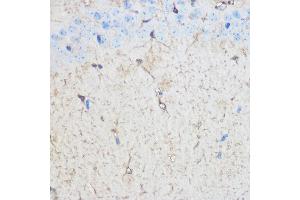 Immunohistochemistry of paraffin-embedded Mouse brain using S100B Rabbit pAb (ABIN3021047, ABIN3021048, ABIN3021049, ABIN1513496 and ABIN6213928) at dilution of 1:100 (40x lens). (S100B Antikörper  (AA 1-92))