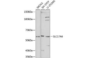 Western blot analysis of extracts of various cell lines, using SLC17 Polyclonal Antibody (ABIN7270407) at 1:1000 dilution. (Solute Carrier Family 17 (Vesicular Glutamate Transporter), Member 6 (SLC17A6) (C-Term) Antikörper)