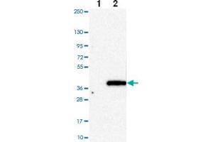 Western blot analysis of Lane 1: Negative control (vector only transfected HEK293T lysate) Lane 2: Over-expression Lysate (Co-expressed with a C-terminal myc-DDK tag (~3. (HAPLN2 Antikörper)