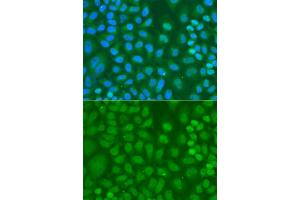 Immunofluorescence analysis of HeLa cells using CXXC1 antibody. (CXXC1 Antikörper)