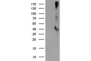 Western Blotting (WB) image for anti-Microtubule-Associated Protein, RP/EB Family, Member 2 (MAPRE2) antibody (ABIN1499318) (MAPRE2 Antikörper)