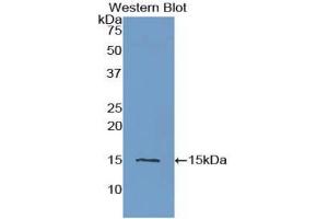 Detection of Recombinant CST3, Human using Polyclonal Antibody to Cystatin C (Cys-C) (CST3 Antikörper  (AA 27-146))