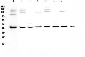Western blot analysis of WWOX using anti-WWOX antibody .
