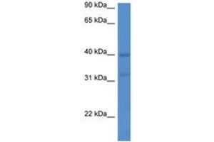 Image no. 1 for anti-Melatonin Receptor 1A (MTNR1A) (C-Term) antibody (ABIN6747396) (Melatonin Receptor 1A Antikörper  (C-Term))