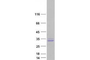 NKX2-6 Protein (Myc-DYKDDDDK Tag)