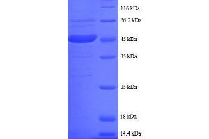 UBE2I Protein (AA 1-157, partial) (GST tag)
