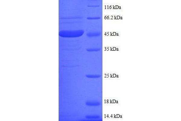 UBE2I Protein (AA 1-157, partial) (GST tag)