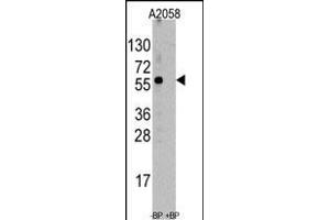 Western blot analysis of anti-ST13 Antibody (N-term) (ABIN390183 and ABIN2840674) pre-incubated with and without blocking peptide (BP6247a) in  cell line lysate. (HSC70 Interacting Protein HIP Antikörper  (AA 50-80))
