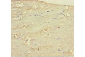 Immunohistochemistry of paraffin-embedded human skeletal muscle tissue using ABIN7159662 at dilution of 1:100 (WDR77 Antikörper  (AA 1-312))