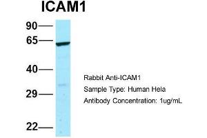 Host: Rabbit  Target Name: ICAM1  Sample Tissue: Human Hela  Antibody Dilution: 1. (ICAM1 Antikörper  (N-Term))