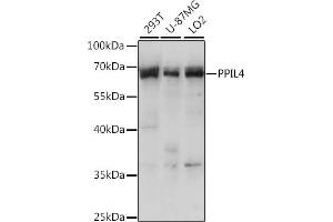 Western blot analysis of extracts of various cell lines, using PPIL4 antibody (ABIN7269212) at 1:1000 dilution. (PPIL4 Antikörper  (AA 301-492))
