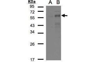 WB Image Western Blot analysis of EGR2 expression in transfected 293T cell line by EGR2 polyclonal antibody. (EGR2 Antikörper)