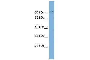 WB Suggested Anti-FBXO34 Antibody Titration: 0. (FBXO34 Antikörper  (Middle Region))