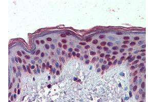 IHC Image of AP23070PU-N Human Skin: Formalin-Fixed, Paraffin-Embedded (FFPE) (HMGA1 Antikörper  (Internal Region))