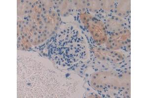 IHC-P analysis of Kidney tissue, with DAB staining. (GSTa2 Antikörper  (AA 1-222))