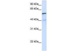 UGT1A6 antibody used at 1 ug/ml to detect target protein. (UGT1A6 Antikörper  (C-Term))